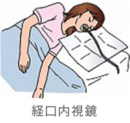 経口内視鏡のイメージイラスト